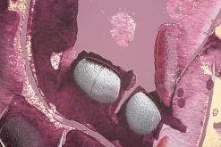 Mauro Ferretti Impression sur toile violet feuilles cm 80x3x120- Panneau Tasseau Bois